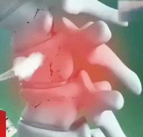 كيف يعمل المرهم